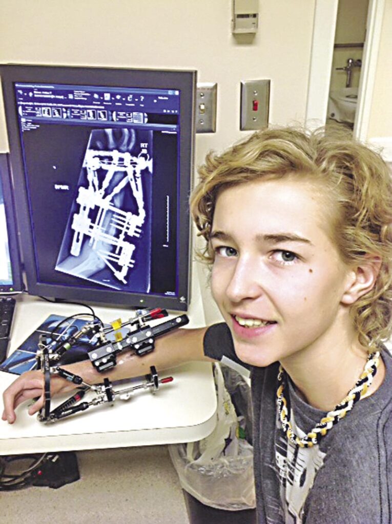 Camlachie teen has arm lengthened