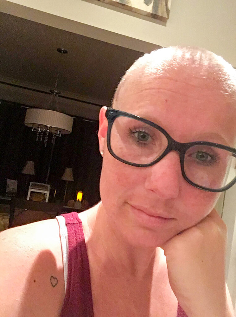 City woman ready for second round in cancer fight