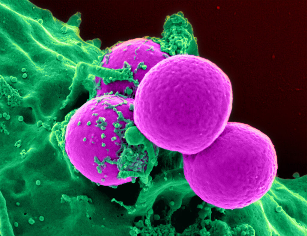 We can all help thwart rise of superbugs, expert says