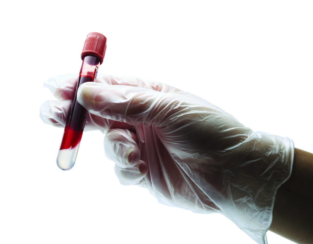 Sarnia-Lambton won’t get vaccine for “weeks,” MPP says