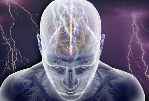The epilepsy stigma